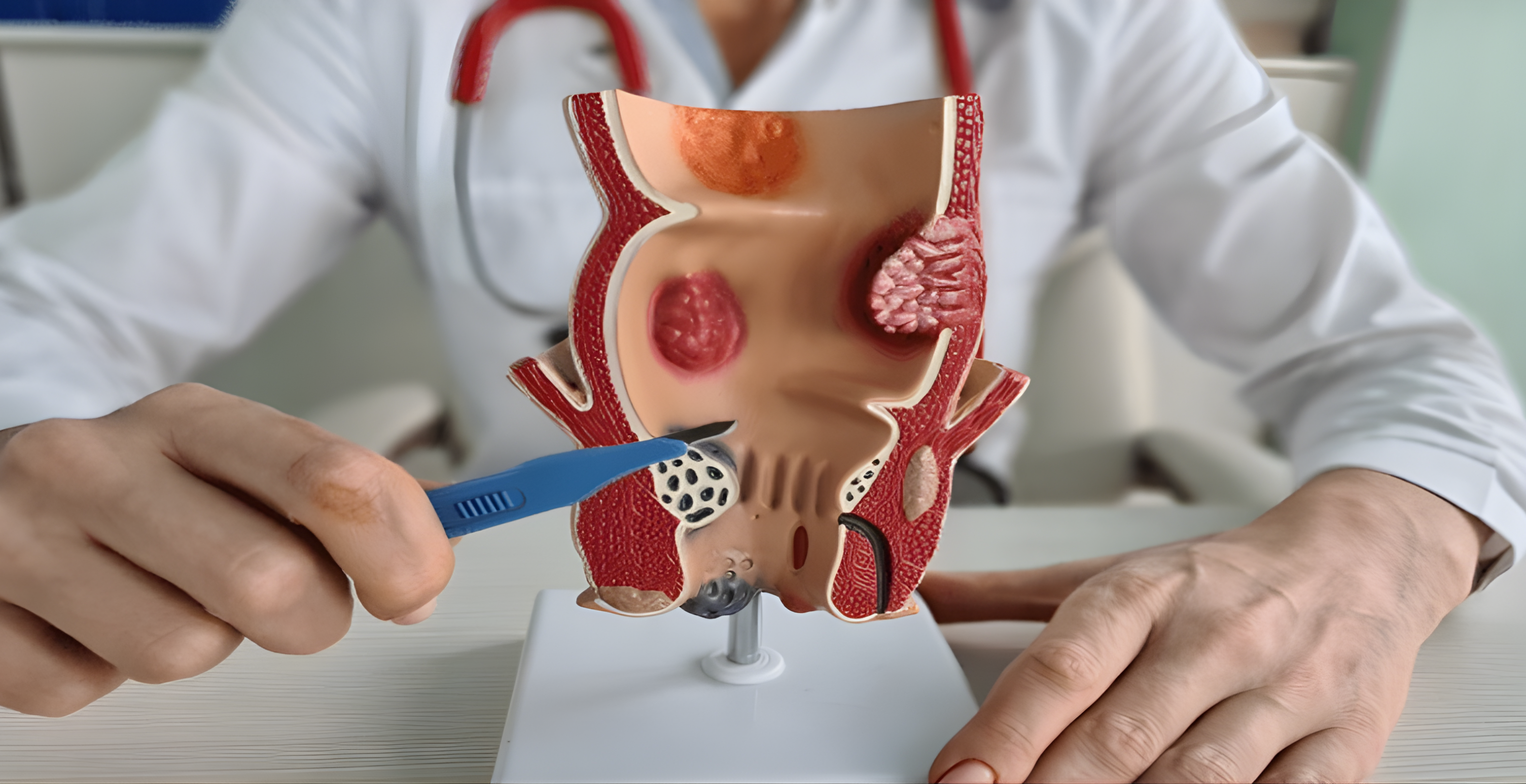 Dr. MD. Sabir Pasha - Laser Proctology Specialist